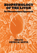 Biopathology of the Liver : An Ultrastructural Approach-9789401070492