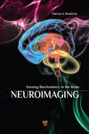 Neuroimaging : Sensing Biochemistry in the Brain-9789814613491