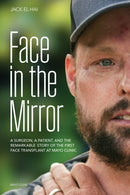 Face Transplant : How Medical Science Gave a Man a New Face and Restored His True Identity-9798887700281