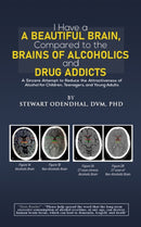 I Have a Beautiful Brain, Compared to the Brains of Alcoholics and Drug Addicts : A Sincere Attempt to Reduce the Attractiveness of Alcohol for Children, Teenagers, and Young Adults-9798889109907